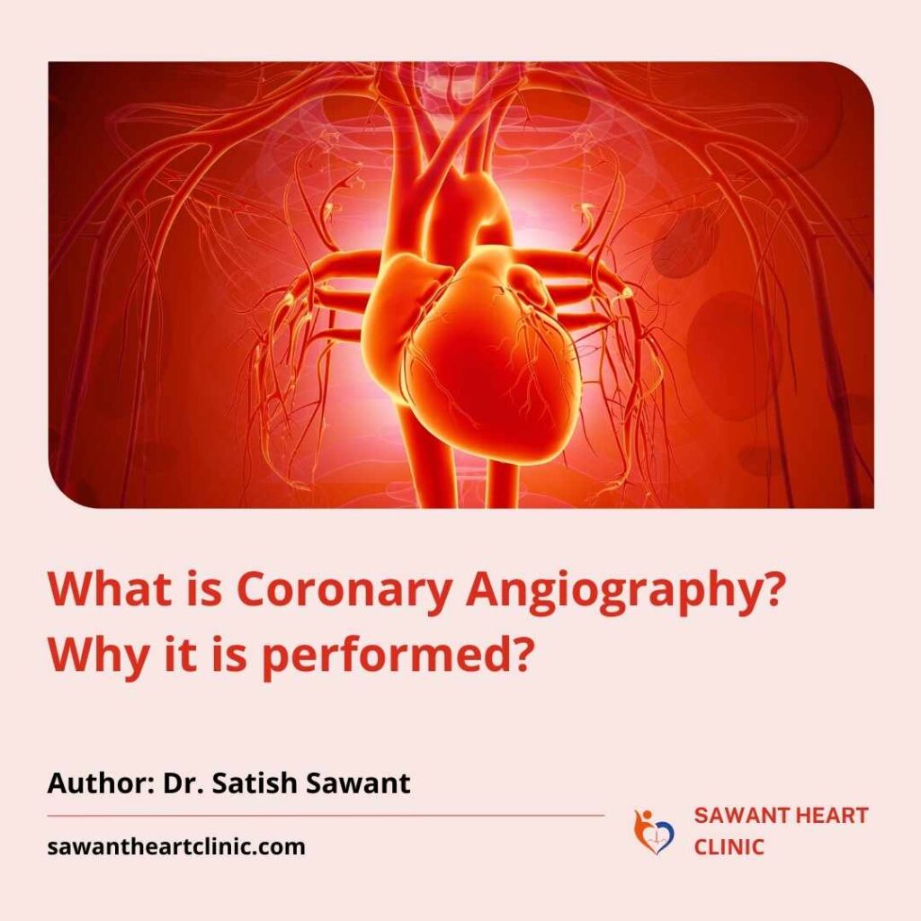 Angiography Clinic in Pune | What is angiography