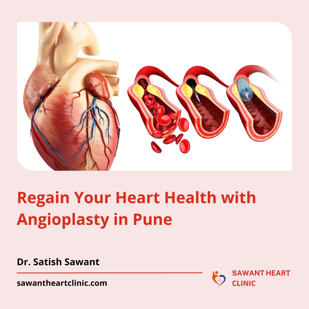 Regain Your Heart Health with Angioplasty in Pune
